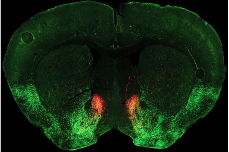 This shows a brain slice with serotonin neurons in the Nca highlighted