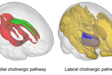 This shows brain scans from the study