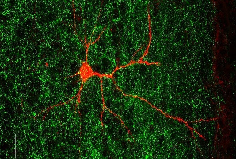 Autism-Linked Gene Found to Shape Nerve Connections - Neuroscience News