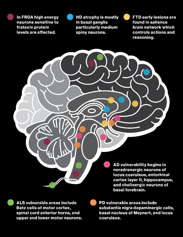 This shows a diagram of the brain