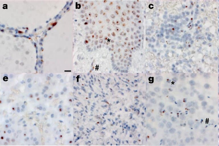 This shows a tissue sample