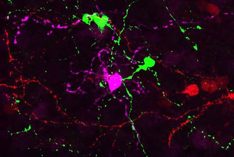 Le cellule gangliari sono state create nei topi nel tentativo di riparare gli occhi malati