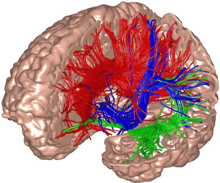 This shows a schematic diagram of the brain