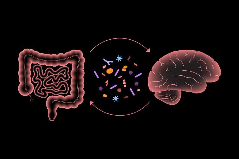 This is a drawing of a brain and intestines