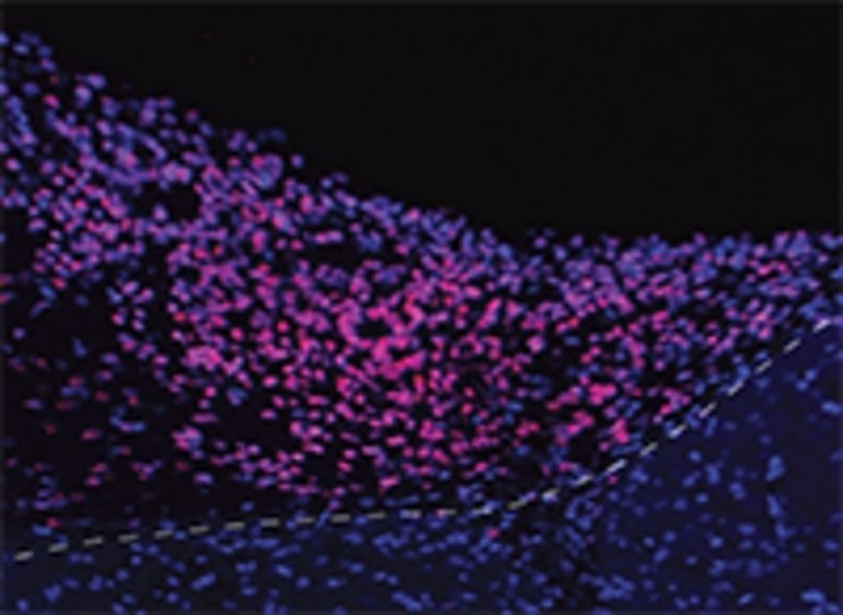 Human Brain Organoids Implanted Into Mouse Cortex Respond to Visual Stimuli for First Time - Neuroscience News