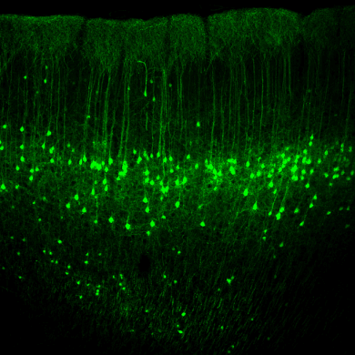 This shows neurons in the motor cortex