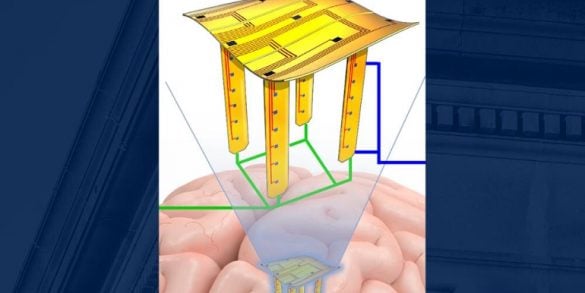 This is a drawing of the electrode over a brain