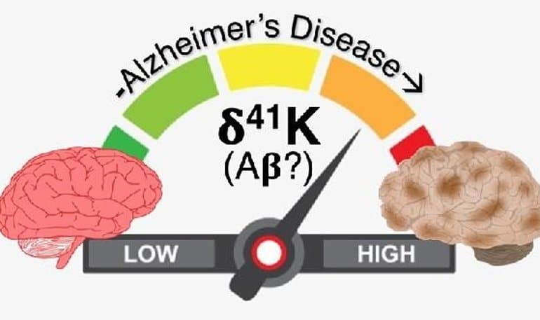 This shows a sliding scale and two brains