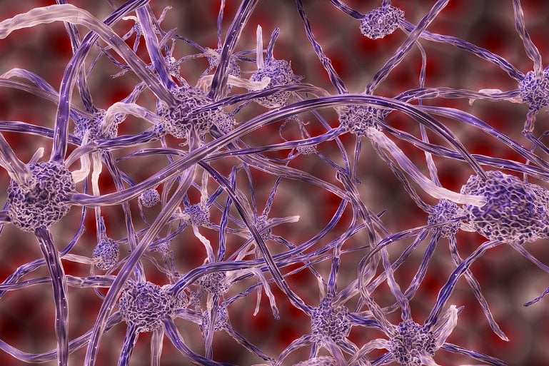This shows a computer-generated neuron