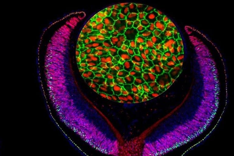 This shows an image of the cells within an eye