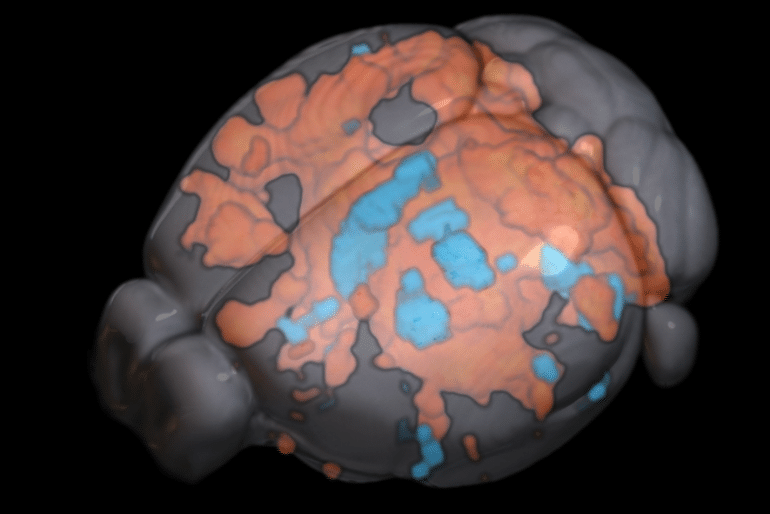 This shows a brain map with the stimulated areas highlighted orange and blue