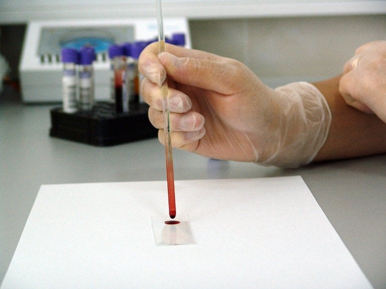 This shows a researcher testing a blood sample