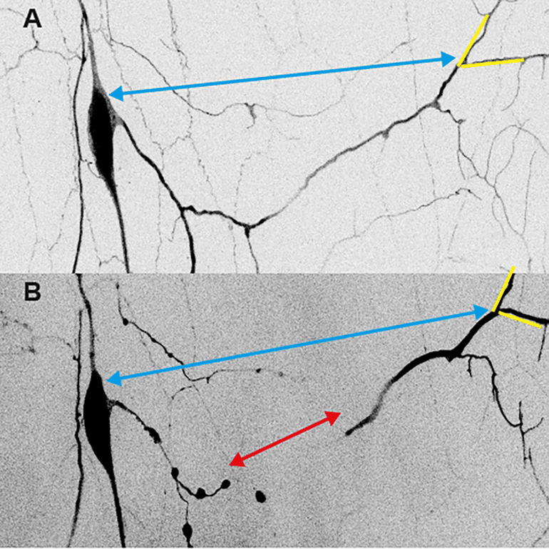 This shows dendrites