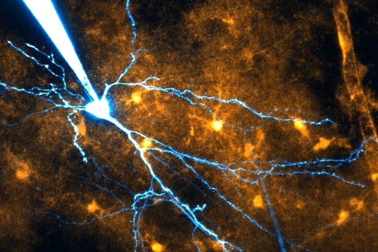 This shows astrocytes