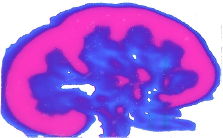 This shows a cross section of a kidney