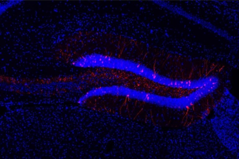 This shows neurons in the hippocampus