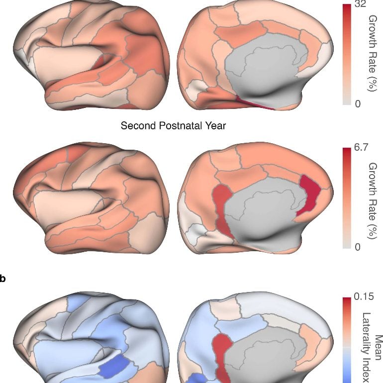 This shows different brain maps