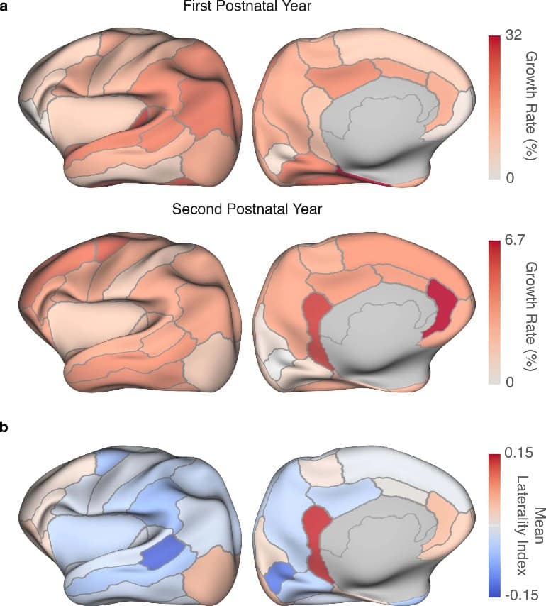 This shows different brain maps