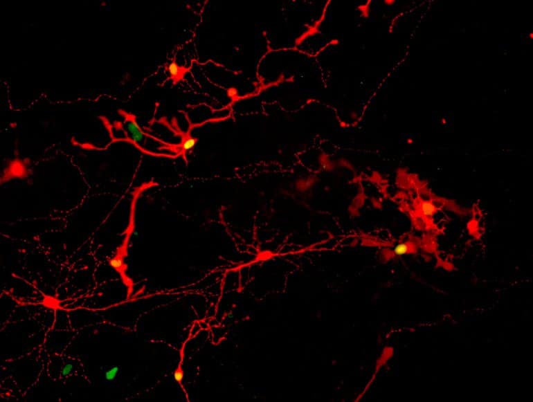 Questo mostra le cellule staminali della retina