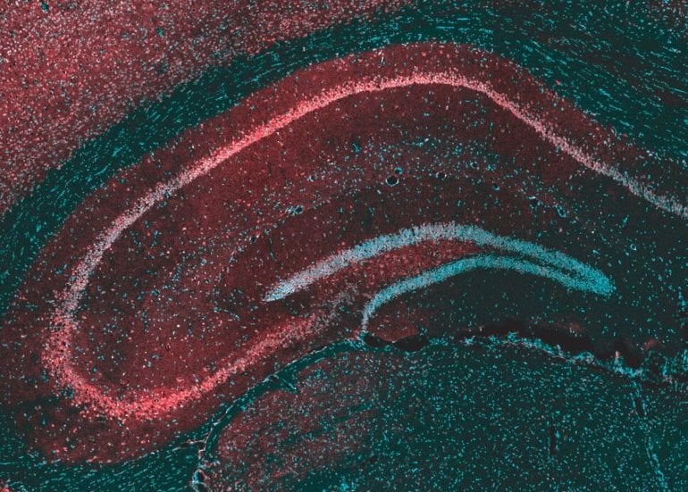 This shows a hippocampal brain slice