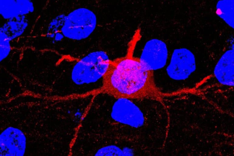 This shows a medium spiny neuron in the nca