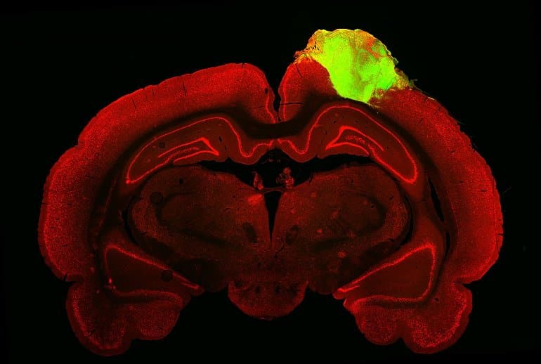 This shows the organoid grafted onto a brain slice