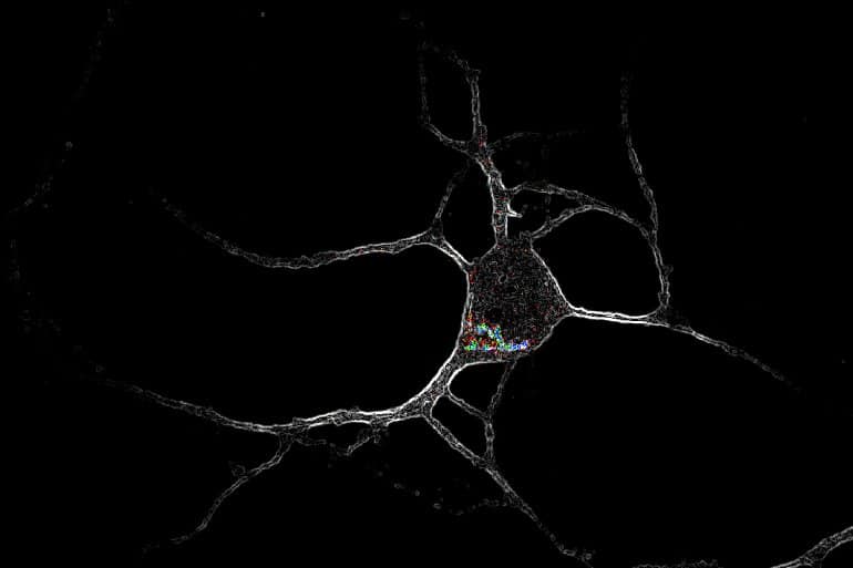 This shows a cortical neuron