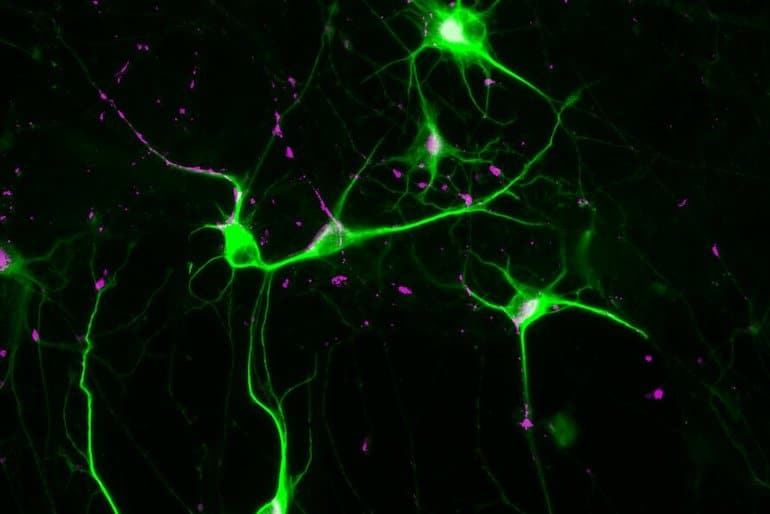 Potential Therapeutic Target for Schizophrenia Identified - Neuroscience News