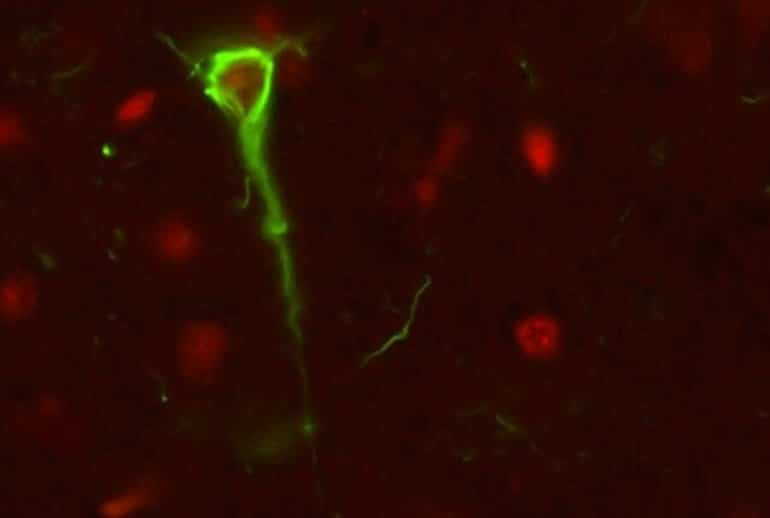 This shows tau-RNA