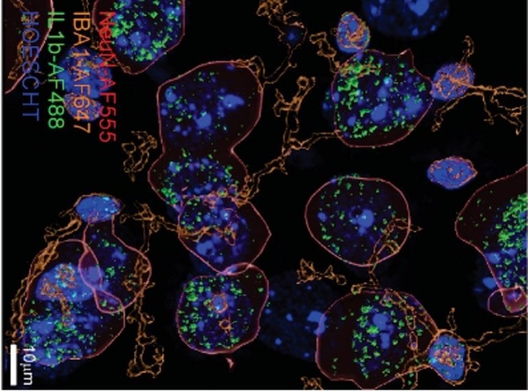 This shows interleukin 1B in neurons