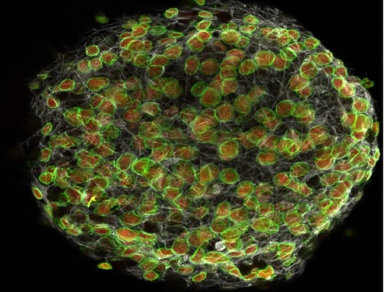 This shows neural stem cells
