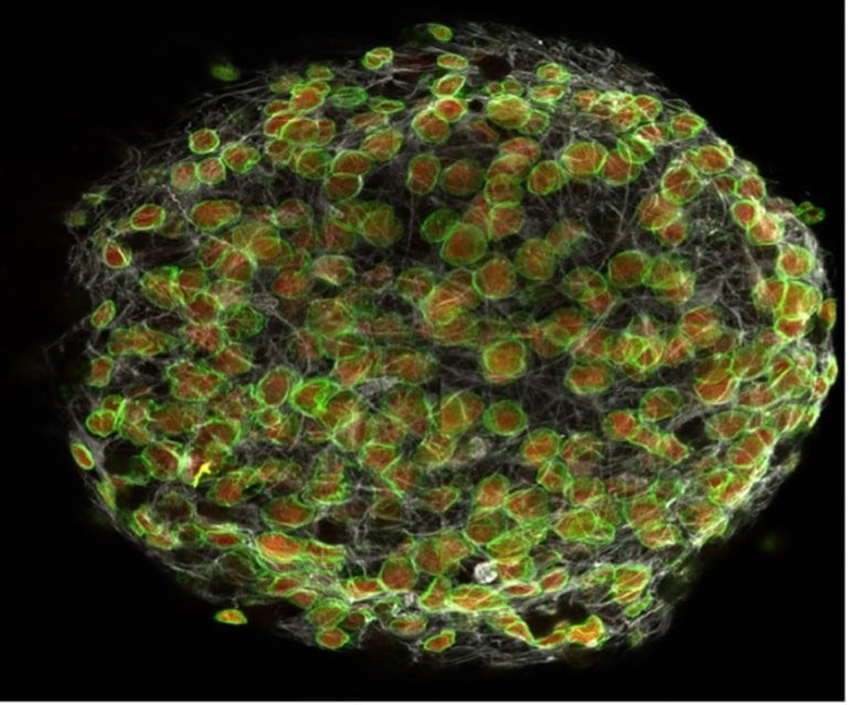This shows neural stem cells