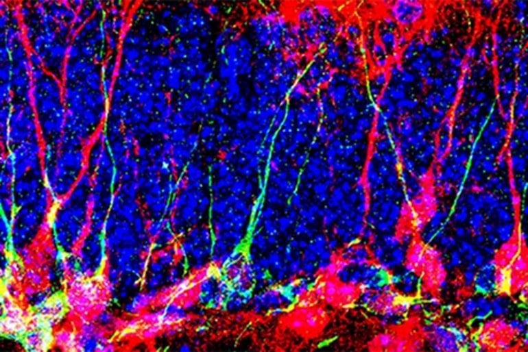 This shows newly produced neurons in the dentate gyrus