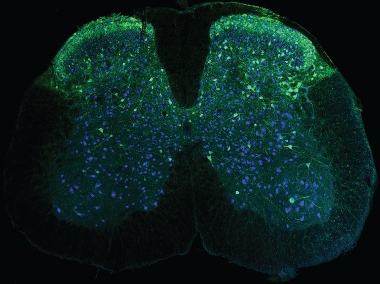 This shows spinal cord neurons