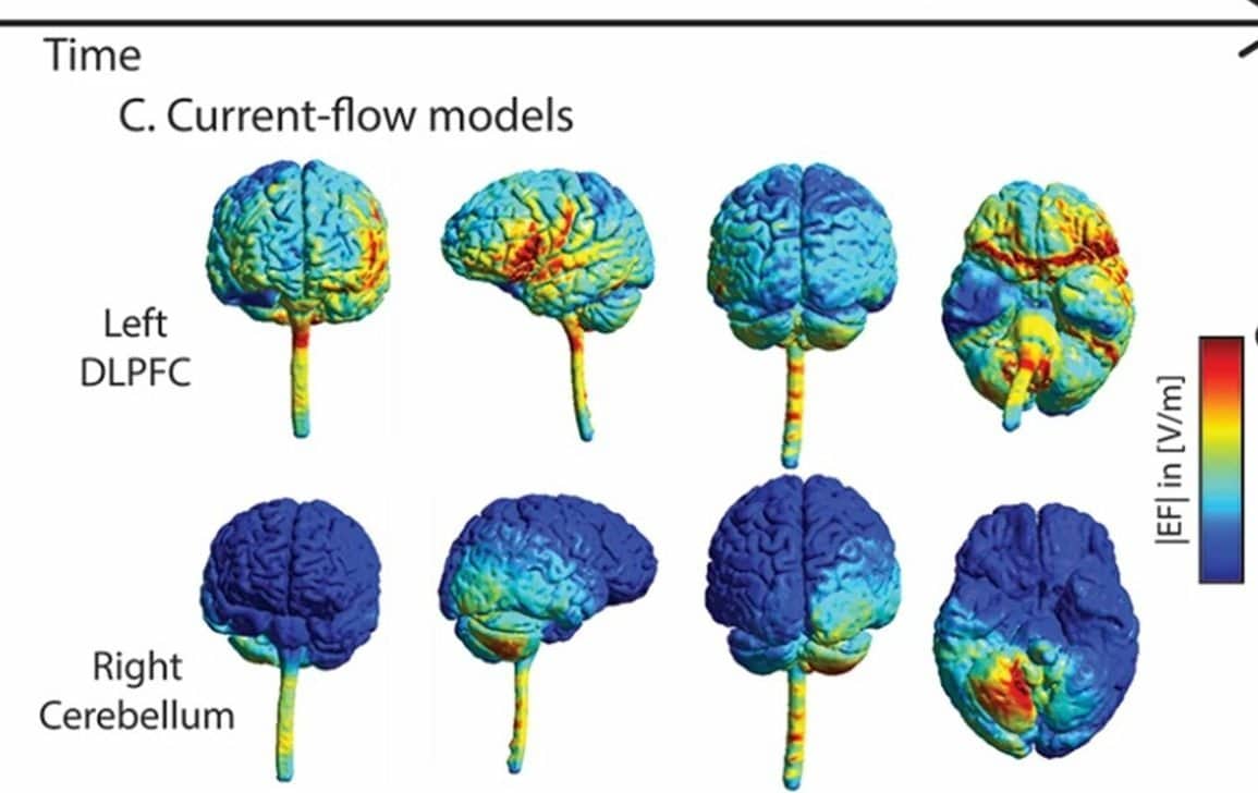 This shows the cerebellum