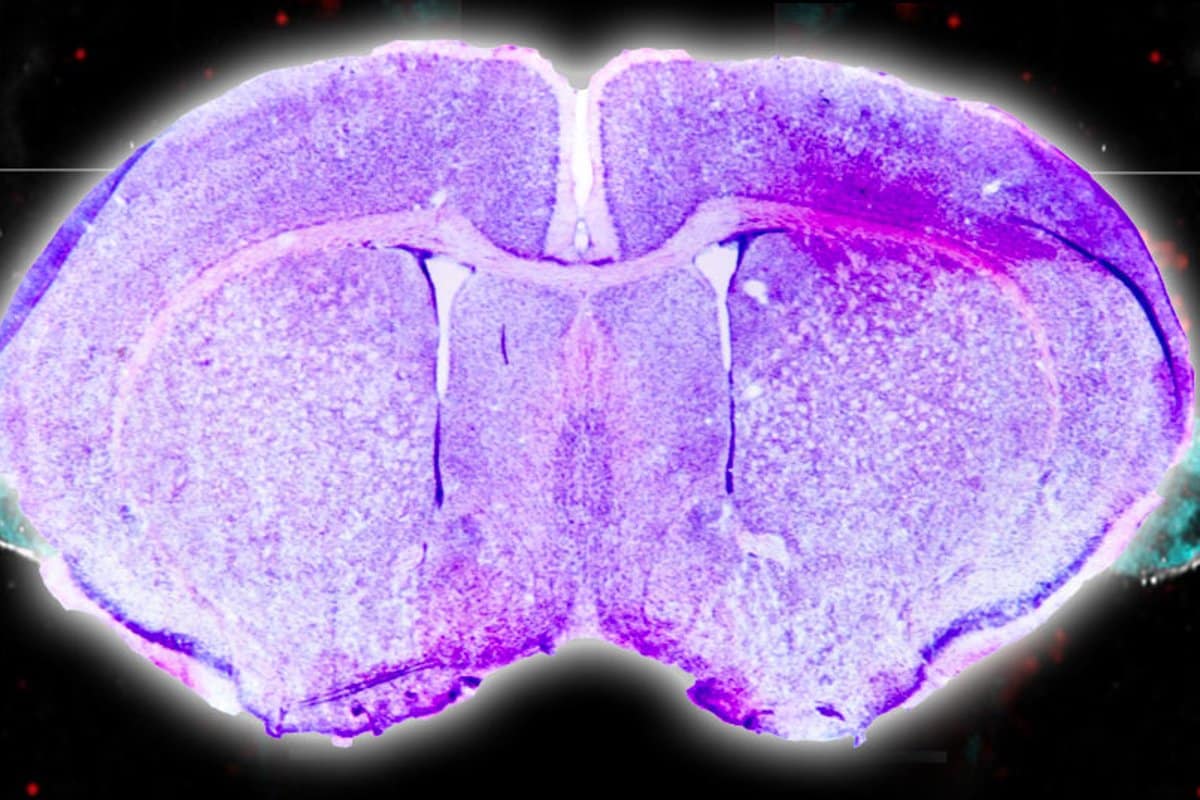 This shows a brain slice