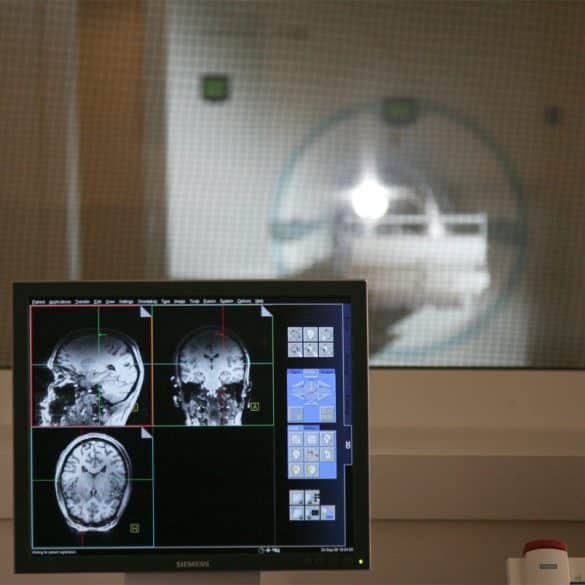 This shows brain scans and a MRI machine