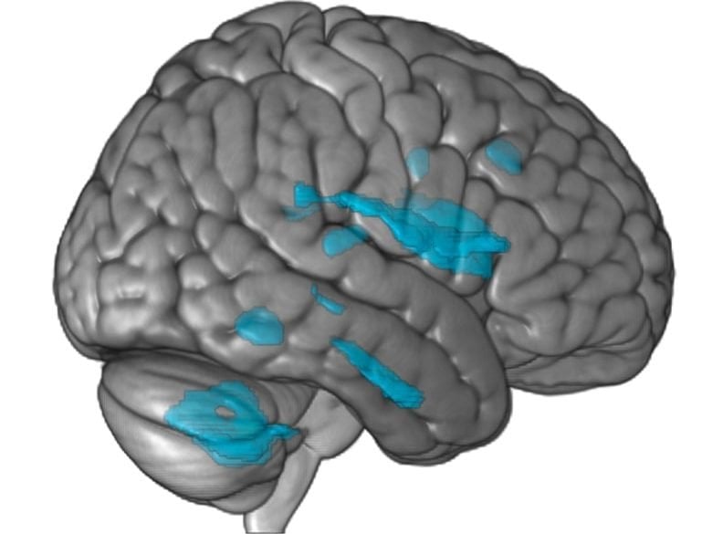This shows a brain with the areas mentioned in the study highlighted