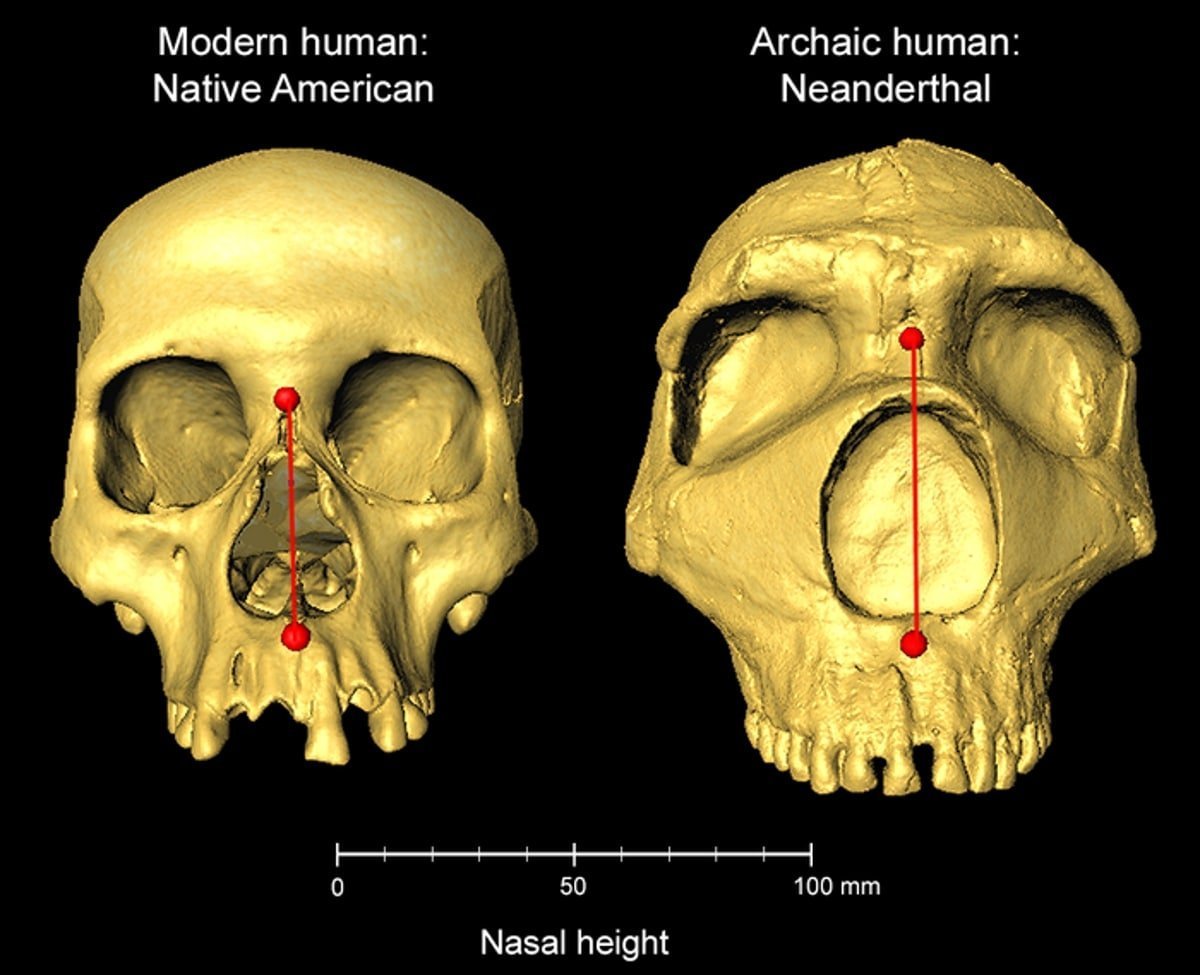 Neanderthal DNA shapes the human nose