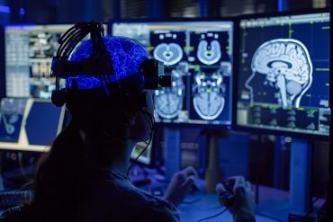 This shows a person looking at brain scans.