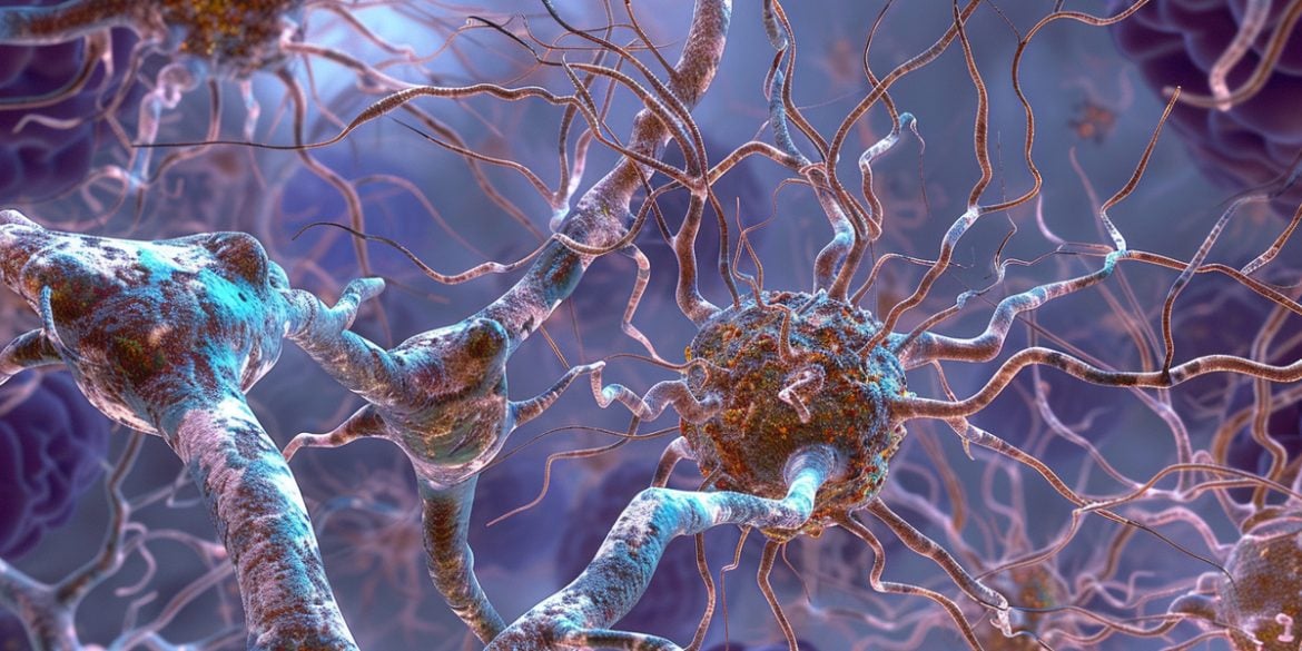 Cycle of Decline: Neuron Aging in Alzheimer’s Unraveled