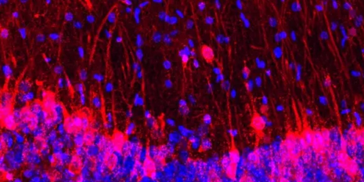 This shows hippocampal cells.