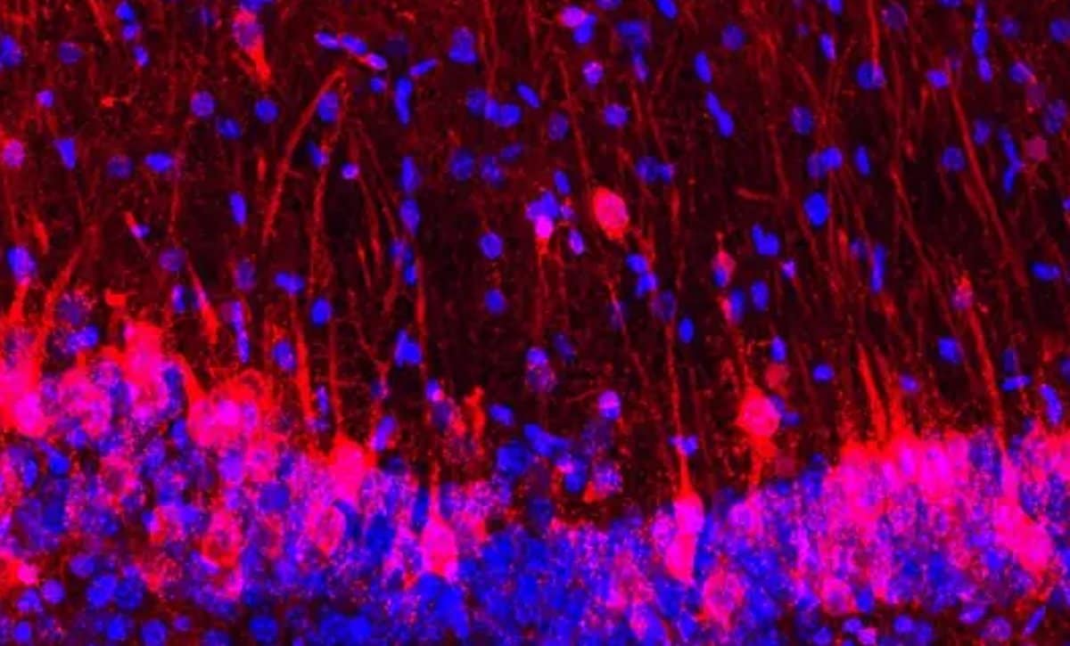 This shows hippocampal cells.