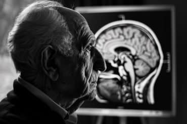 This shows an older man and a brain scan.
