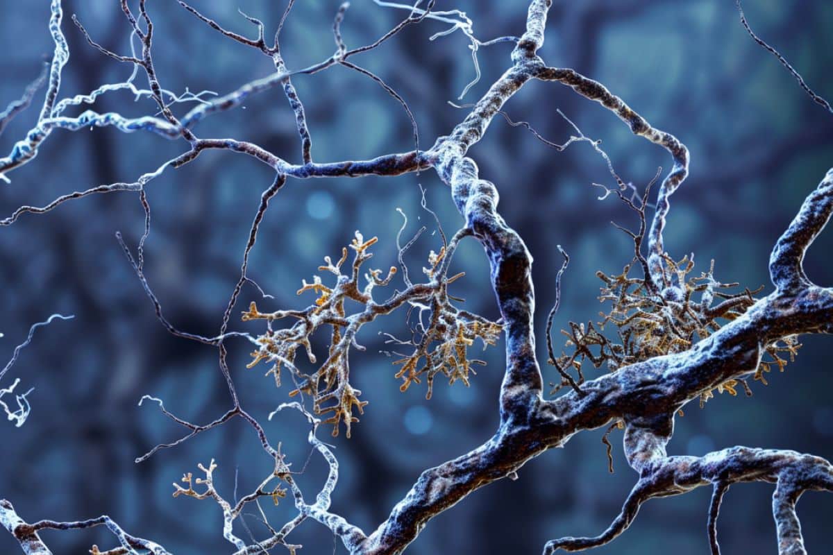 Learn about Unearths Construction of Alzheimer’s Molecules in Human Mind – Neuroscience Information