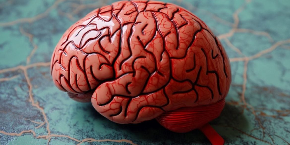 This shows a brain.