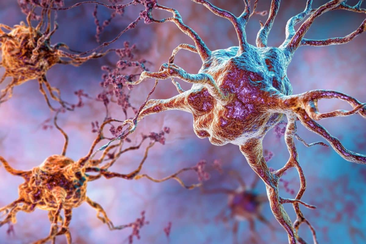 Two New Proteins Linked to ALS