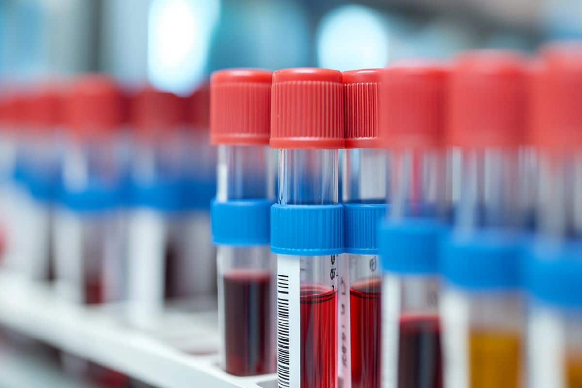 Blood sample allows rapid detection of brain cancer