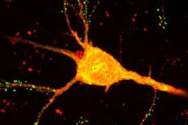 This shows a neuron.