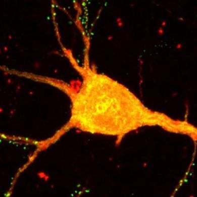 This shows a neuron.